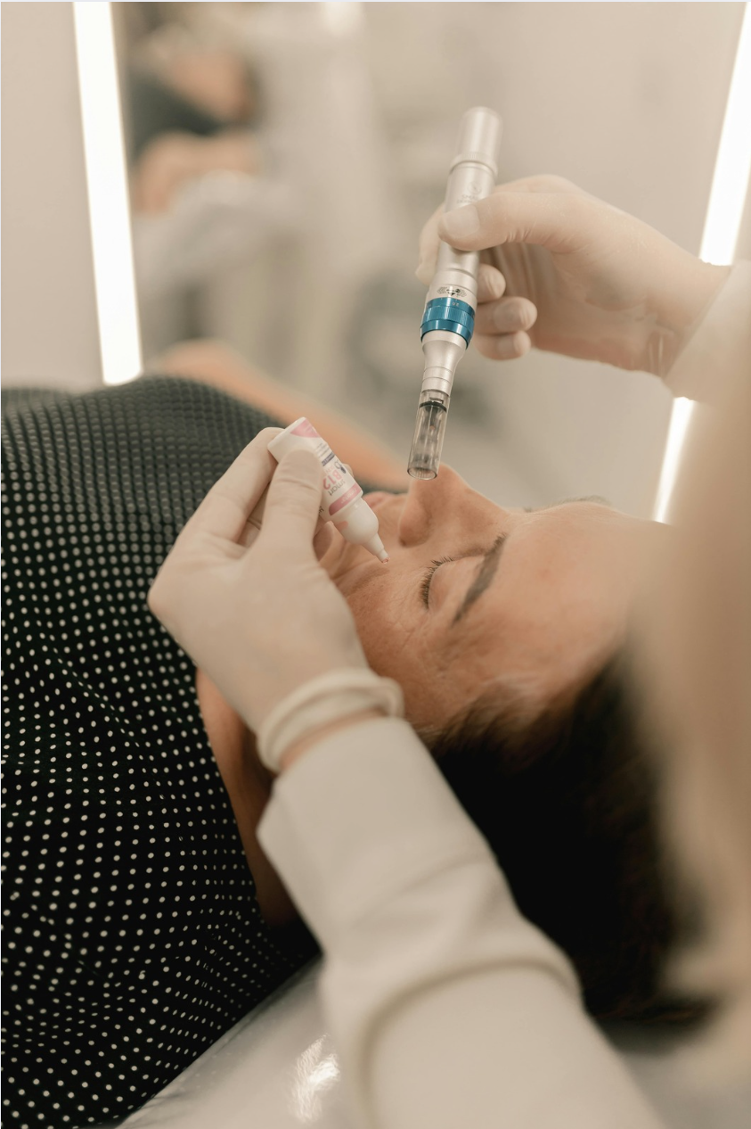 Mnrf treatment microneedling with radio frequency microneedling rf pimple scar removal laser pimple scars laser treatment pimple scar on chin scar removal in hyderabad acne scars hyderabad mnrf treatment in hyderabad acne and laser scar removal treatment in hyderabad acne pimples scar treatment in hyderabad acne scar clinic in hyderabad acne scar removal hyderabad acne scar removal treatment in hyderabad