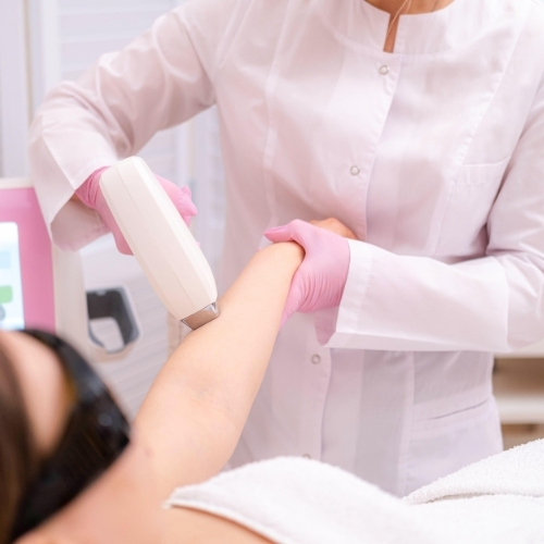 Laser hair removal