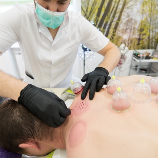 Cupping therapy for neck pain